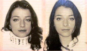 фото до и после массажа горячими мешочками