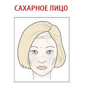 Сахару – бой?